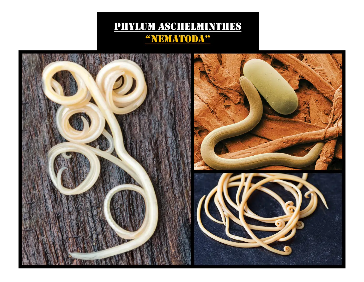 Examples of Phylum Nematoda (Aschelminthes)